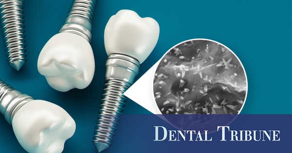 مول دنت لطب الاسنان promo